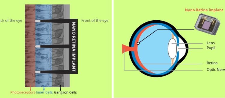 bioretina